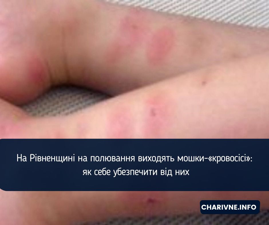 Фото ілюстративне